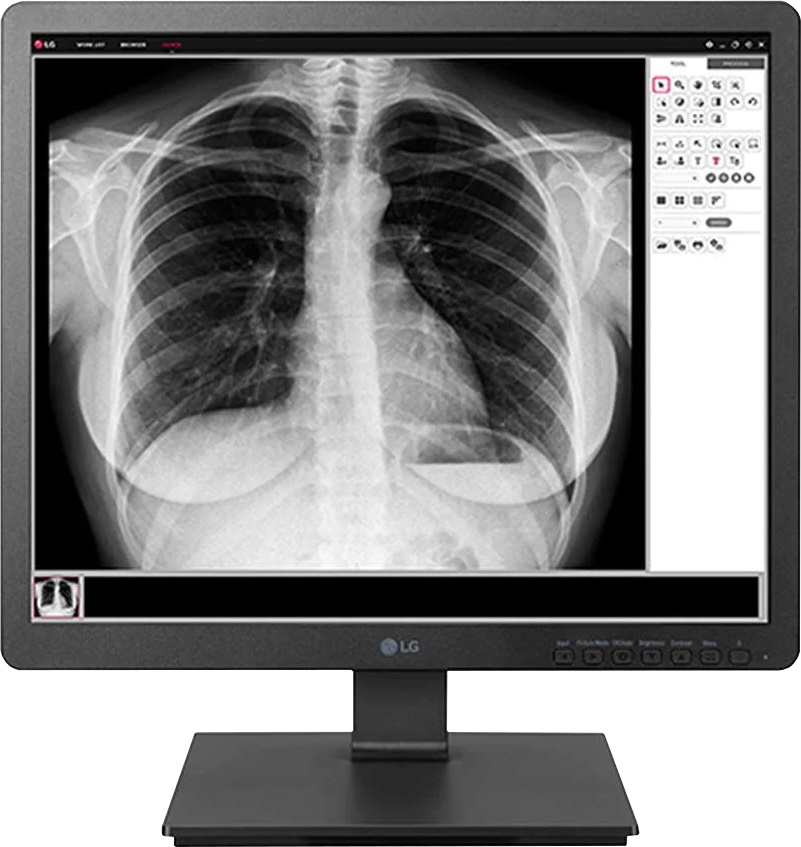 LG 19HK312C-B